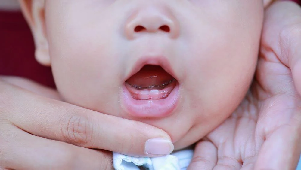 dentitia bebelusului si copilului - primii dintisori