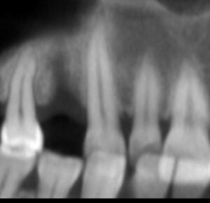 radiografie dentara