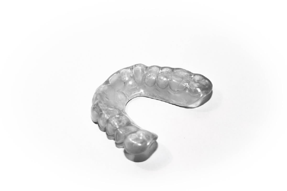 Gutiera pentru bruxism – cea mai utilizata metoda pentru combaterea efectelor scrasnitului din dinti