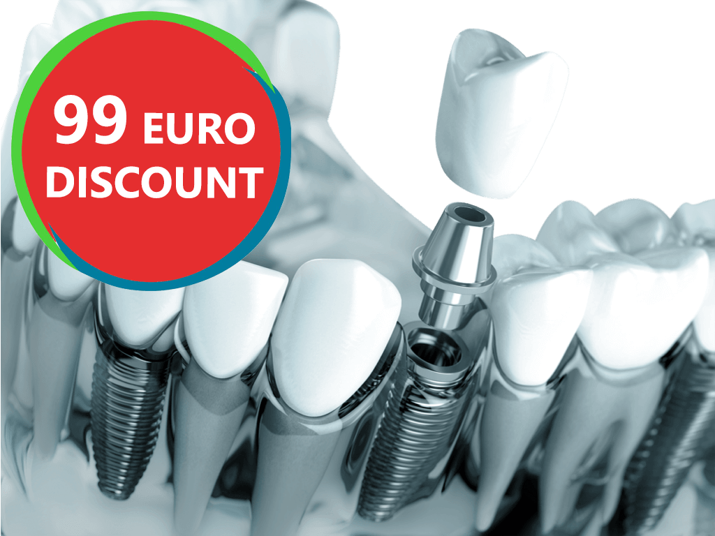 discount implant dentar