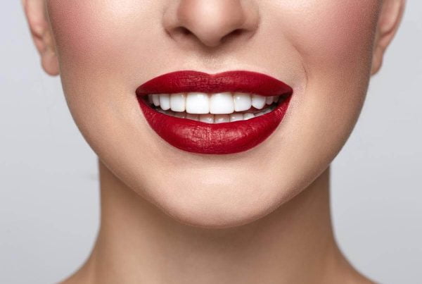 Fatete dentare: Ce sunt, ce avantaje au si cand se folosesc? Afla totul despre fațetarea dintilor si despre zambetele perfecte ca la Hollywood!