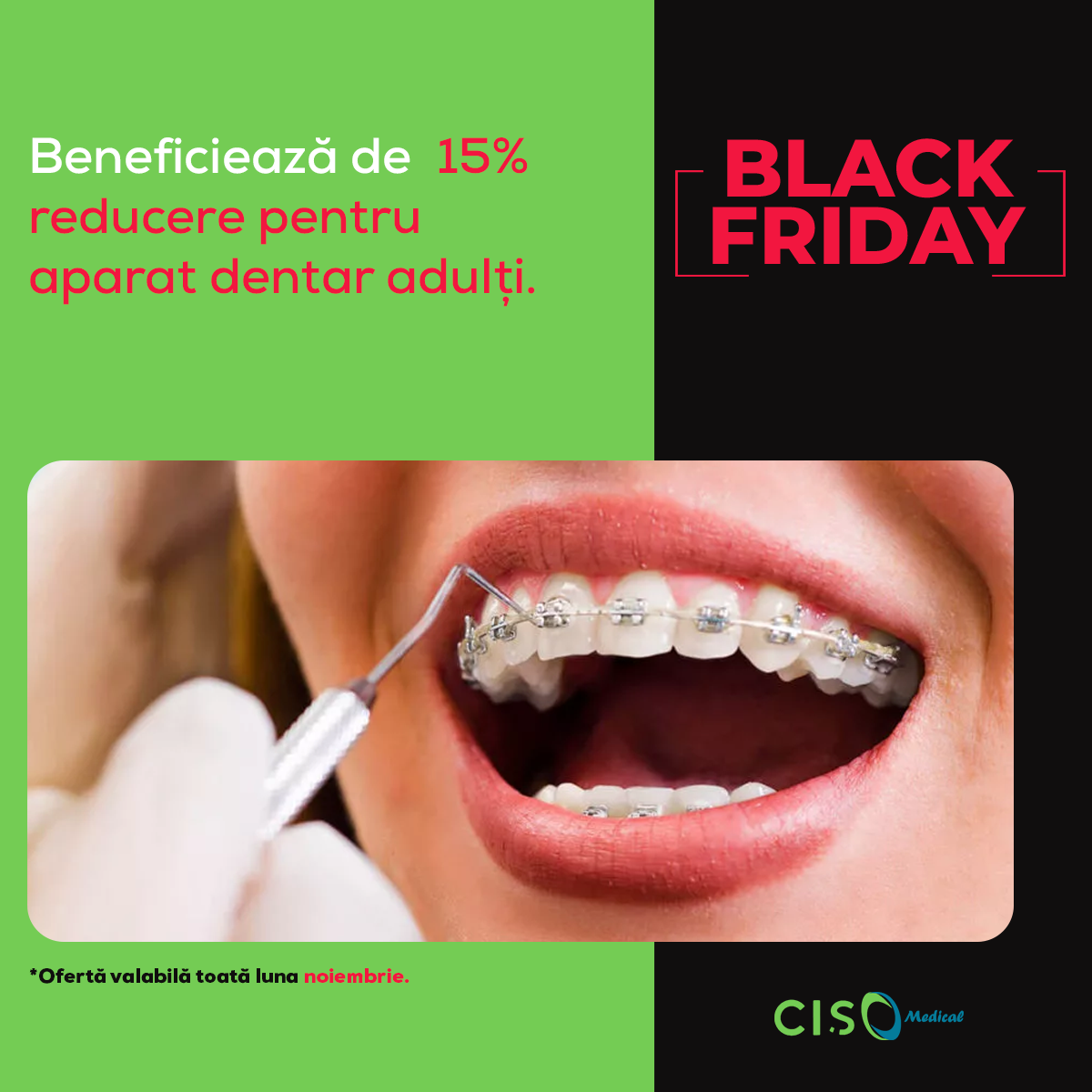 black friday aparate dentare adulti CISO